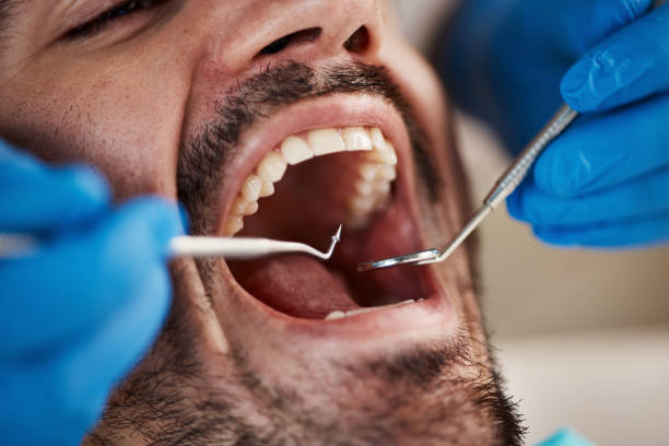 Best Emergency Broken Tooth Repair in Ada, OH